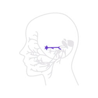 구안와사 누선 분비 감각 이상