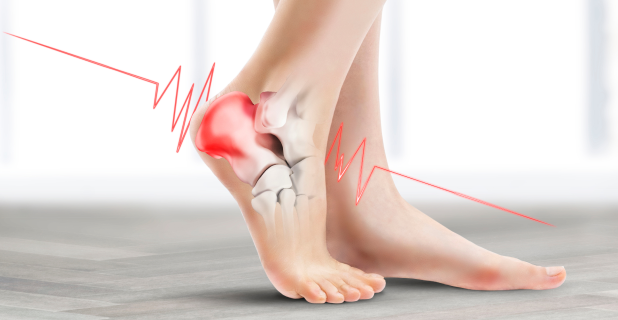 족저 근막염
