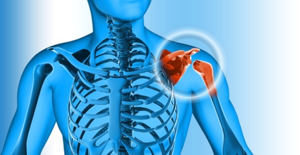 SLAP (상부관절와순파열)