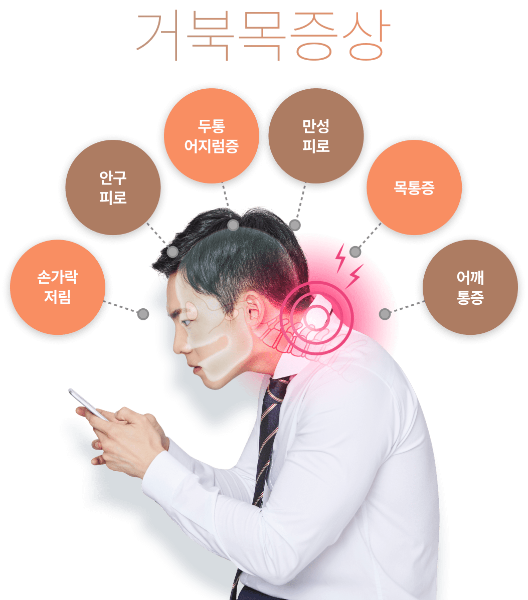 거북목증상 손가락 저림, 안구피로, 두통, 어지럼증, 만성피로, 목통증, 어깨통증