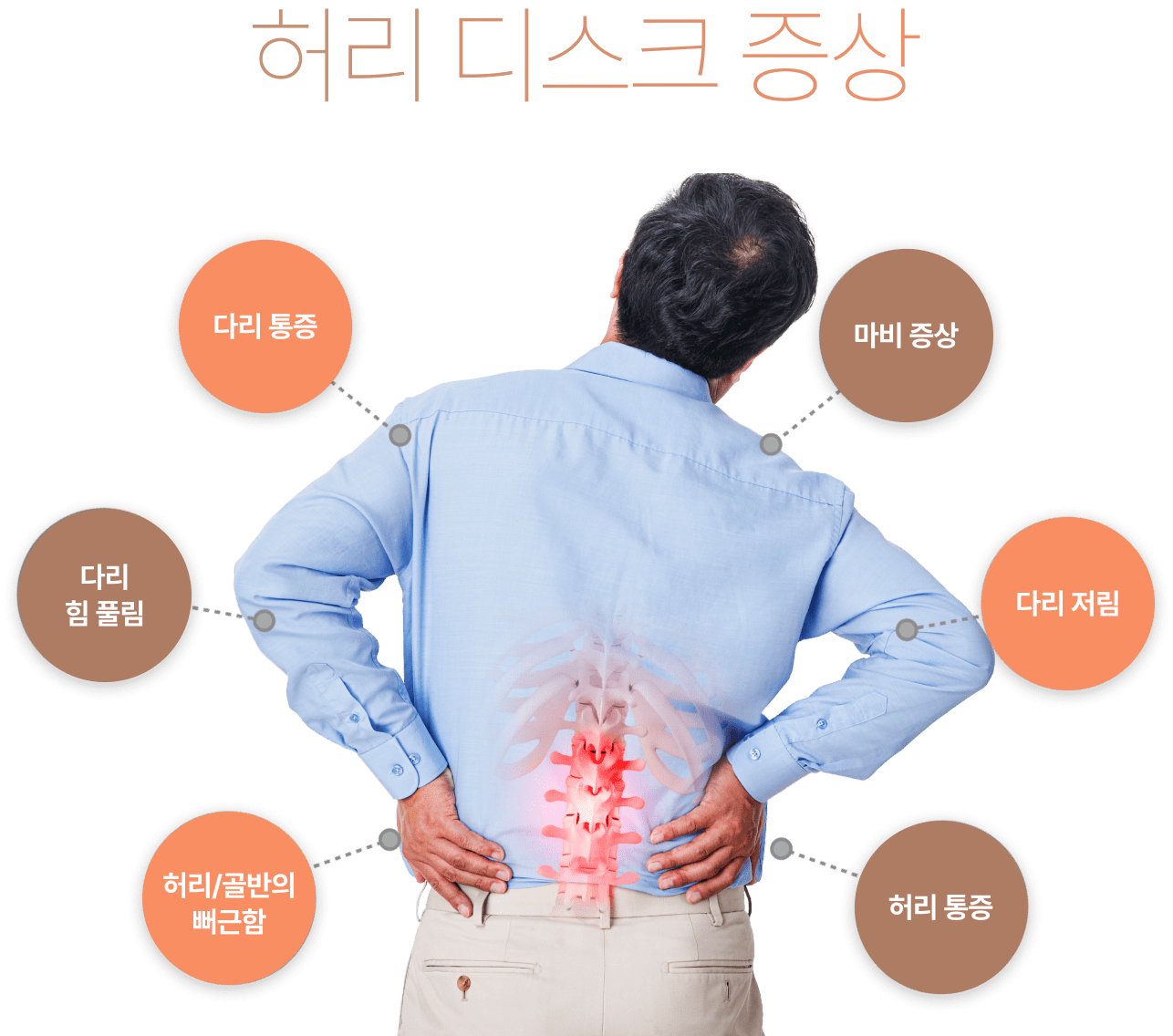허리 디스크 증상 다리 통증, 다리 힘 풀림, 허리/골반의 뻐근함, 마비 증상, 다리 저림, 허리 통증