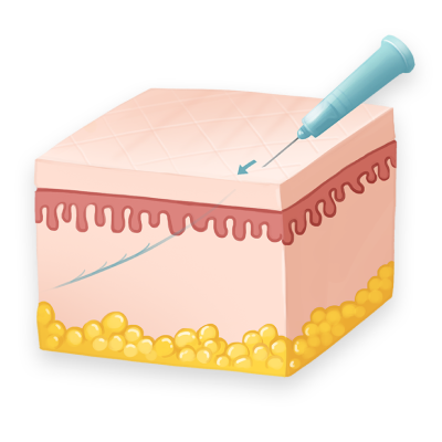 STEP 2 혈자리 자극, 세포 활성화 근육당김 효과