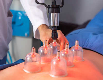 습부항 침 치료